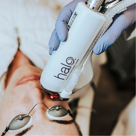 Laser Treatment