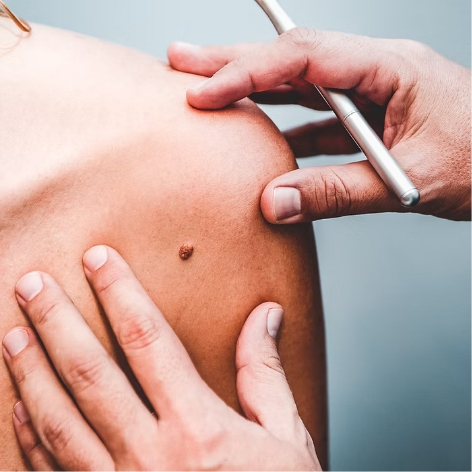 Skin Surgery